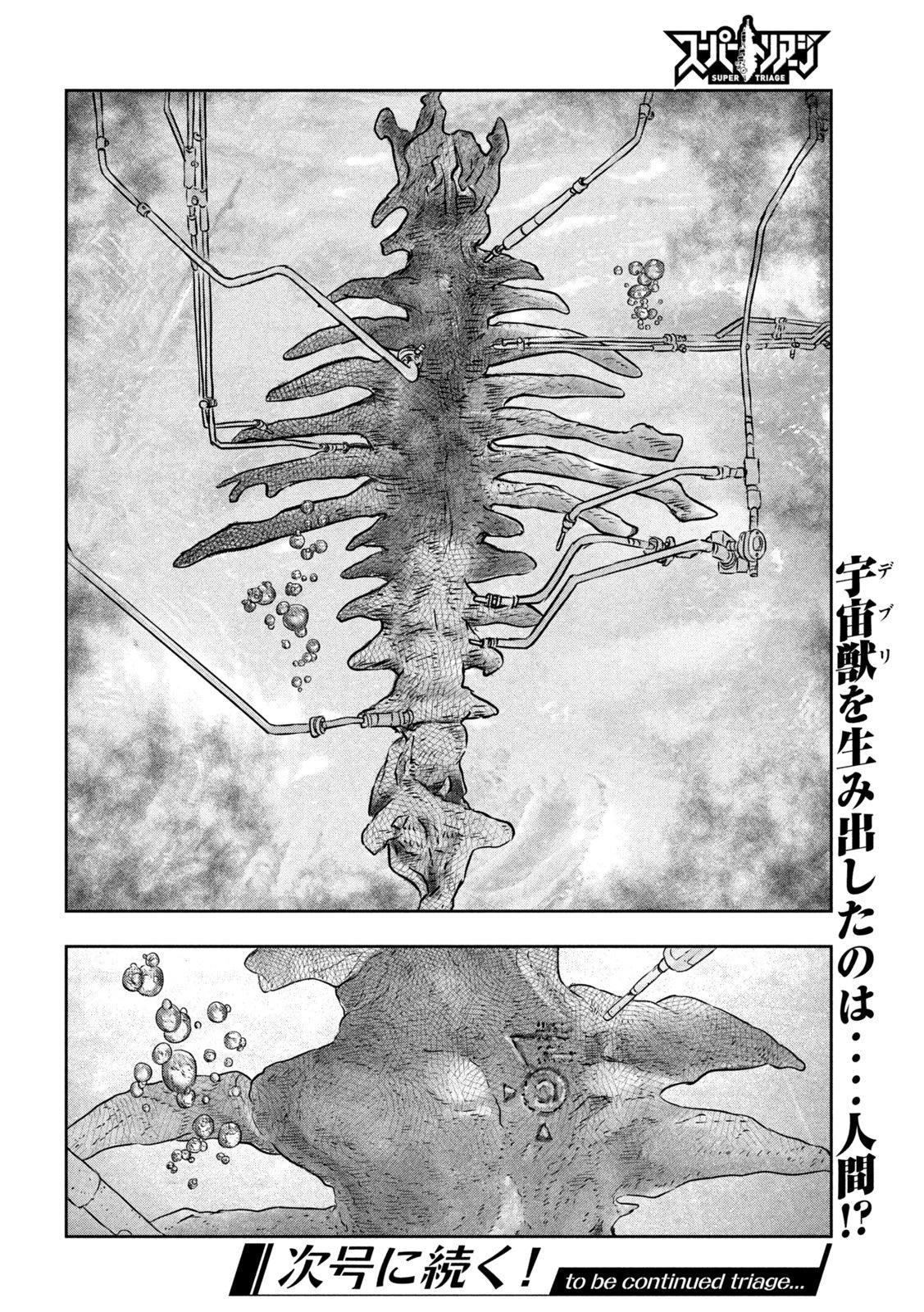 スーパートリアージ 第8話 - 20