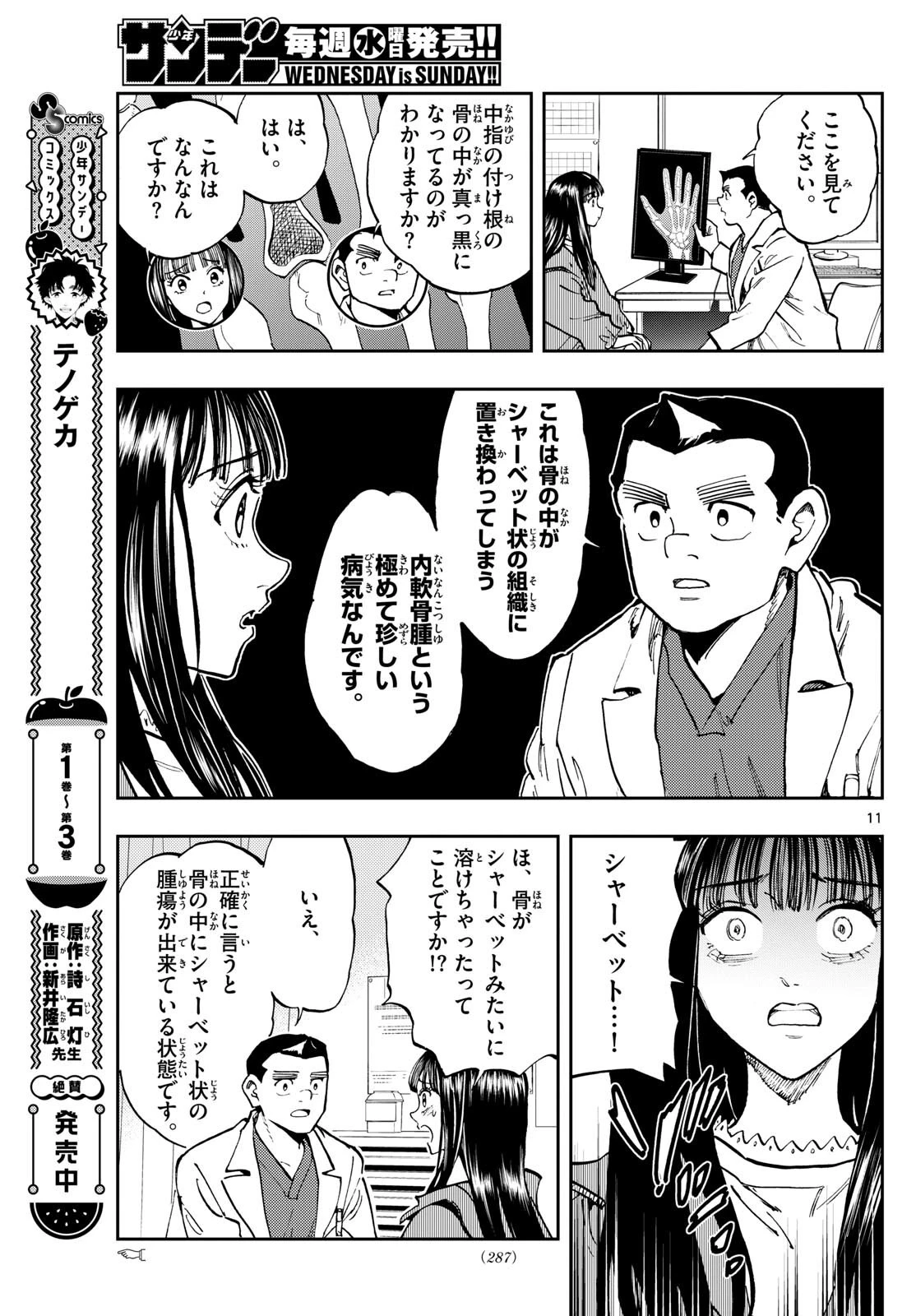 テノゲカ 第32話 - 11
