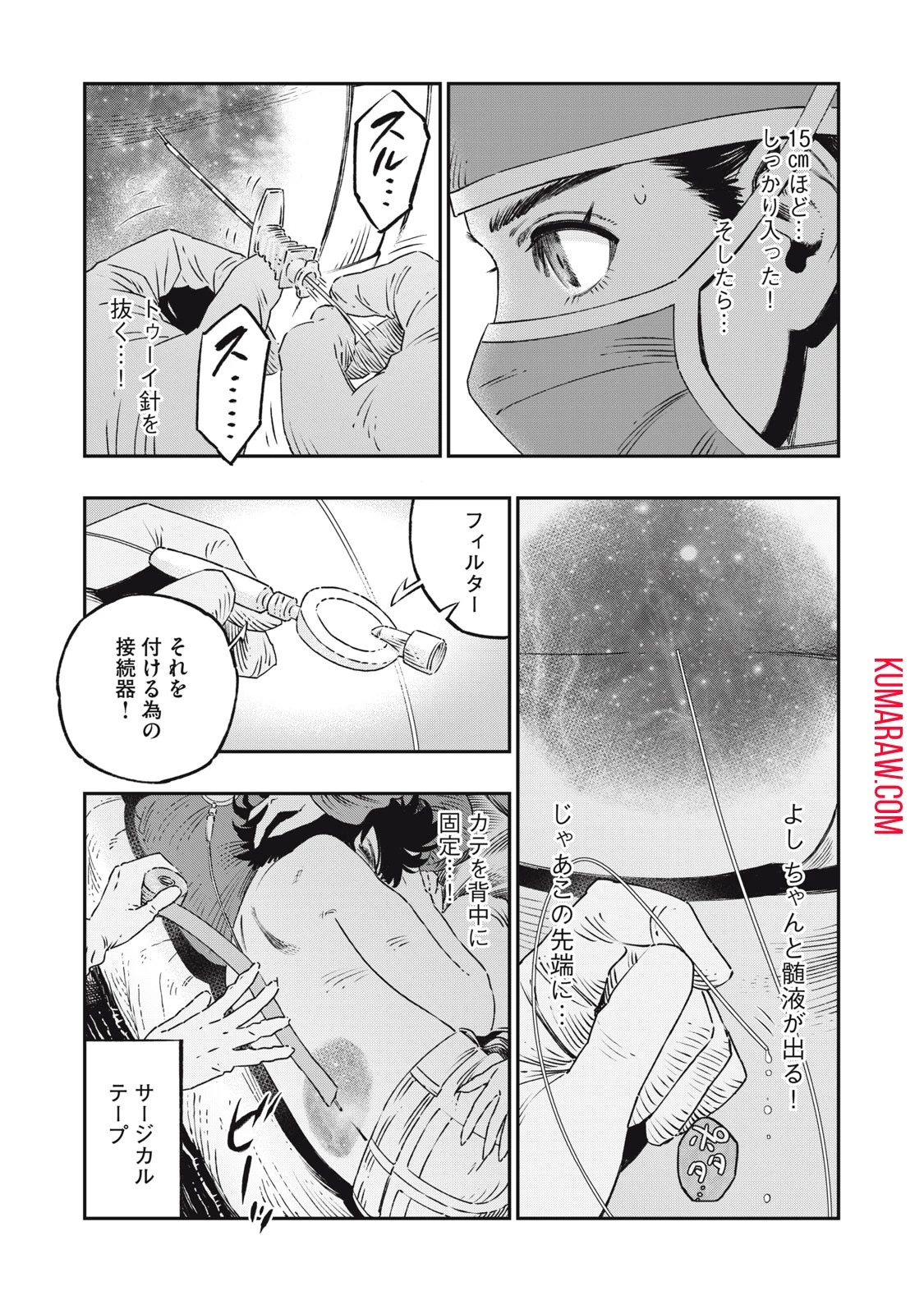 高度に発達した医学は魔法と区別がつかない 第17話 - 19