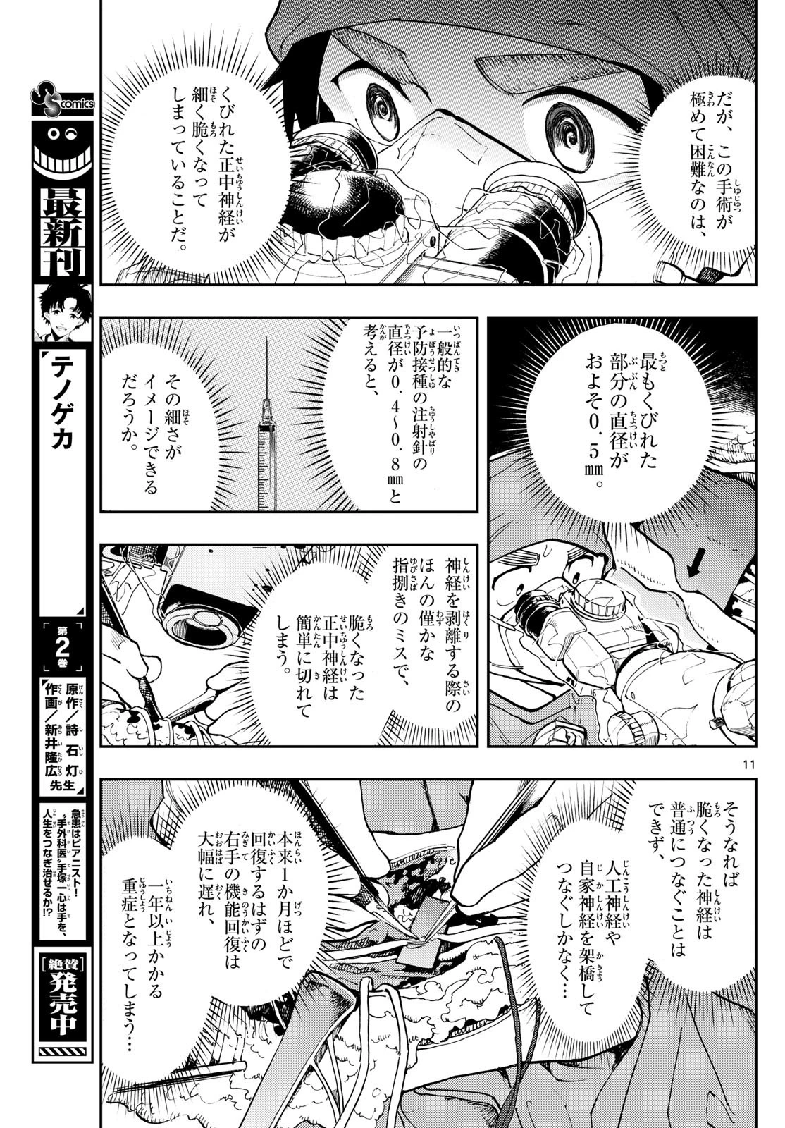 テノゲカ 第18話 - 11